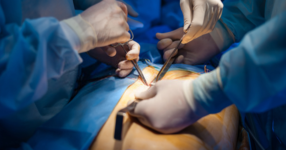laparoscopic surgeon in singapore